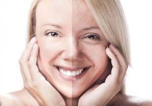 three for me sun damage laser treatment park ridge IL
